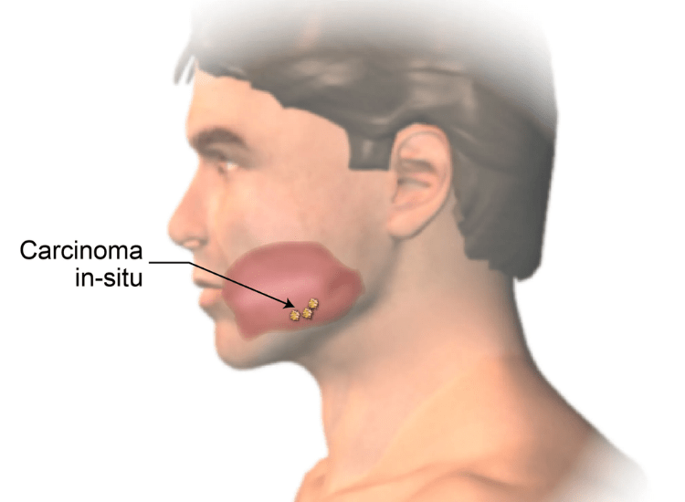 Best-Oral-Treatment-in-Mumbai-dr-Tofiq-Bohra-min