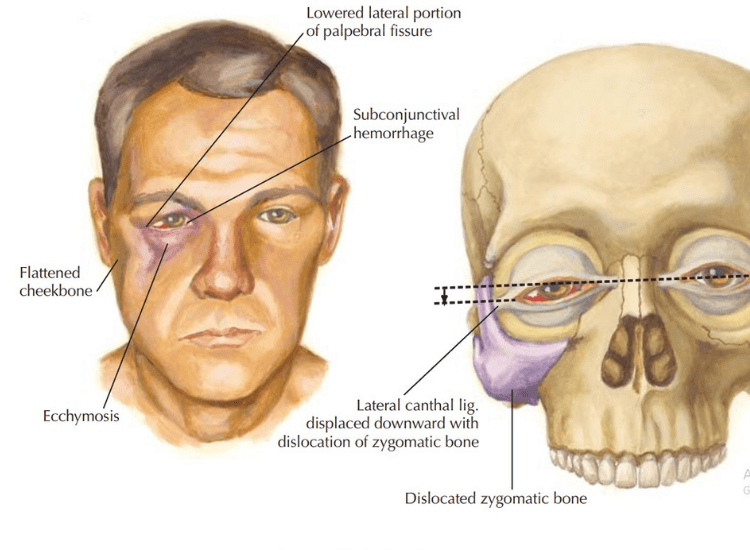 dr-tofiq-bohra-best-Facial-Fractures-surgeon-in-Mumbai-1-min